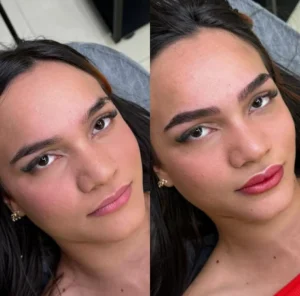 01 - IMG - Antes e depois - Neutralização - (Studio Hannayara)