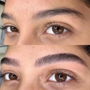 01 - IMG - Antes e depois - (Studio Hannayara)