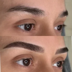 03 - IMG - Antes e depois - (Studio Hannayara)