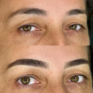 04 - IMG - Antes e depois - (Studio Hannayara)
