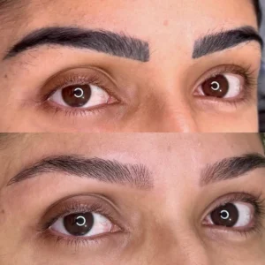 05 - IMG - Antes e depois - (Studio Hannayara)