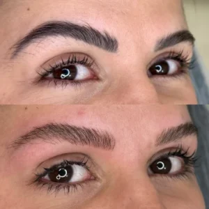 06 - IMG - Antes e depois - (Studio Hannayara)