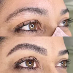 07 - IMG - Antes e depois - (Studio Hannayara)