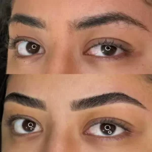 08 - IMG - Antes e depois - (Studio Hannayara)