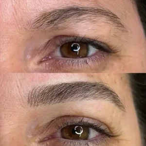 10 - IMG - Antes e depois - (Studio Hannayara)