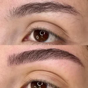 12 - IMG - Antes e depois - (Studio Hannayara)