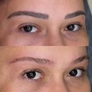 13 - IMG - Antes e depois - (Studio Hannayara)